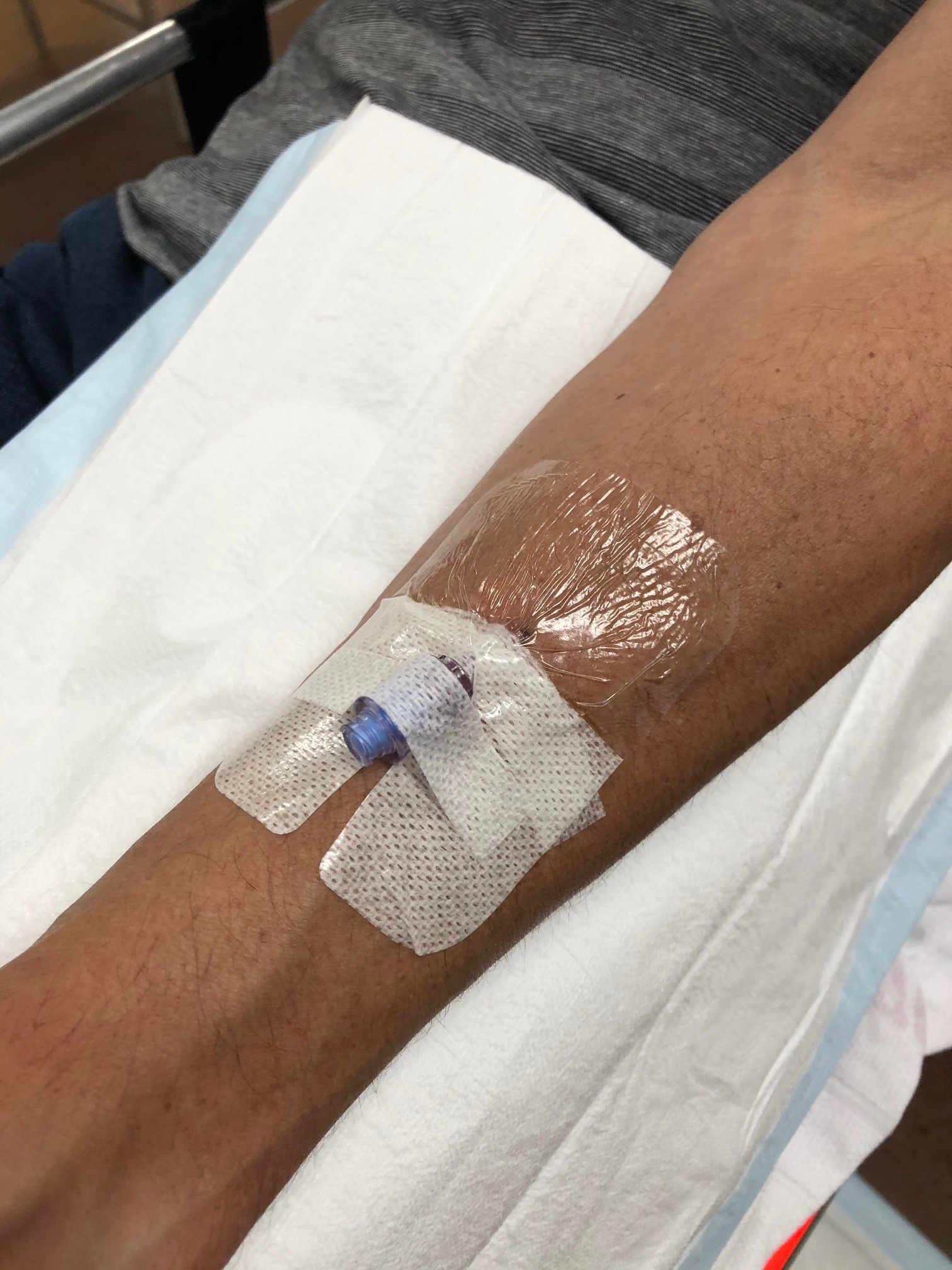 IV cannulation
